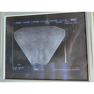 Convex Ultrasound Probe &ndash; Hitachi &ndash; EUP-C715 &ndash; Konvex-Ultraschallsonde